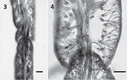 Figs 3–4. Blade anatomy of Udotea geppiorum. Fig. 3. Longitudinal section emphasizing the ‘tongue and groove’ arrangement of concentric segments and bridging medullary siphons between an inferior and a superior segment. Fig. 4. Longitudinal section emphasizing lateral branching of medullary siphons and the dense cortex. Scale bars = 50 μm.