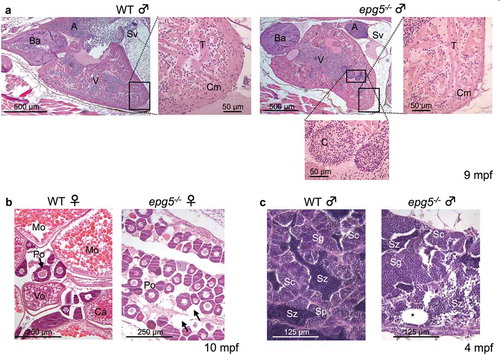 Figure 8. Epg5 deficiency causes multiple tissue defects in adult zebrafish. (a) Effects of Epg5 deficiency on heart morphology in a zebrafish mutant male (9 mpf) in comparison with a WT fish at the same age. The boxed areas are shown at higher magnifications, to compare the compact myocardium structure between the 2 genotypes. epg5-/- heart displays a thinner compact myocardium, with an altered trabecular network containing clumps of red cells. A, atrium; Ba, bulbus arteriosus; C, clump, Cm, compact myocardium; Sv, sinus venosus; T, trabeculae; V, ventricle. (b) Effects of Epg5 deficiency on ovarian morphology in an epg5-/- mutant female (10 mpf), in comparison with a WT fish at the same age. epg5-/- ovary contains only immature stage I oocytes of the perinucleolar stage (Po), whereas WT ovary contains oocytes at different developmental stages. The arrows point at areas of interstitial edema. Ca, cortical alveolus stage oocyte; Mo, mature oocytes; Vo, vitellogenic stage oocyte. (c) Effects of Epg5 deficiency on testicular morphology in a male epg5-/- mutant (4 mpf) in comparison with a WT fish at the same age. Spermatozoa (Sz) and all stages of spermatogenesis are present on WT testis, whereas the tissue structure is disorganized in the epg5-/- testis, which also contains empty tubules (asterisk). Sc, spermatocytes; Sg, spermatogonia.