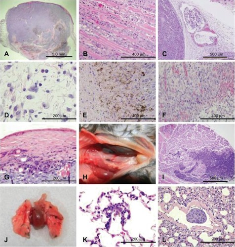 Figure 5 Representative B16F10 melanoma histology (hematoxylin and eosin). Images were captured from all treatment groups. No significant differences in morphology of the tumors or metastases were observed between treatment groups. (A) Subgross image of an expansive subcutaneous melanoma (20×). (B) Invasion of tumor cells into skeletal muscle (200×). (C) Neoplastic cells within lymphatic vessels (200×). (D) Edema with mixed leukocyte infiltrates (400×). (E) Necrotic edges of the tumor (200×). (F) Granulation tissue surrounding the tumor (200×). (G) Necrosis of the skin over the tumor (400×). (H) Gross metastases in the renal lymph node (left kidney and uterus have been moved right across the midline to improve visualization of the renal lymph node). (I) Metastases in the renal lymph node (50×). (J) Gross metastases to the lungs. (K) Micrometastasis in the lung (400×). (L) Metastasis within a blood vessel in the lung (400×).