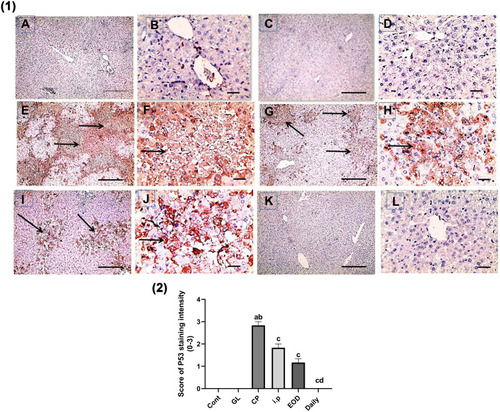 Figure 10 Effect of Ganoderma lucidum on immunoexpression of P53 in rat livers. (1) Representative microscopic pictures of liver sections immunostained using P53 antibody, showing negative staining score (0) in the control group (A and B) and GL group (C and D). Strong positive staining as indicated by intense brown color score (3) in CP group (E and F), moderate positive staining score (2) in i.p treated group (G and H), mild positive staining score (1) in EOD group (I and J) and very mild positive staining score ±1 in daily group (K and L). Black arrows point to positive staining. IHC counterstained with Mayer’s hematoxylin. X: 100 bar 100 (A, C, E, G, I, and K) and X: 400 bar 50 (B, D, F, H, J, and L). (2) Statistical analysis of IHC staining intensity scores in six experimental groups showing significant reduction in P53 in daily group when compared with CP groups. Different small alphabetical letters means significant when P< 0.05. aSignificant against control group; bsignificant against GL group; csignificant against CP group; dsignificant against i.p. group.