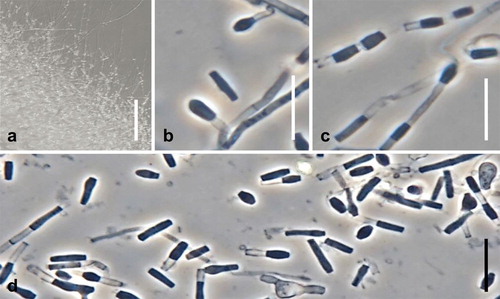 Fig. 11. Spiromastix minimus. Ex-type culture on WA. A. Submerged or aerial conidiophores. B. Conidiophores and conidia. C, D. Terminal and single lateral conidia and arthroconidia. Bars: A = 500 μm, B–D = 10 μm.