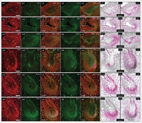 Figure 2. Expression patterns of Ki67, p19INK4d, Cyclin A2, phosphorylated Rb, MSX1 and MSX2 in human incisor tooth germs during the cap stage. Expression patterns of p19INK4d, MSX1, MSX2 and proliferation markers Ki67, Cyclin A2 and pRb in human incisor tooth germ during the cap stage (Magnification: × 20; scale bar: 40 µm); (a1-6) DAPI staining of nuclei (inverted – red color); (b1-6, d1-6) expression patterns of investigated factors in epithelial and mesenchymal compartments of human incisor tooth germ; (c1-6, e1-6) merged image doublets of investigated factors' expression patterns with DAPI; approximation of expression domains for Ki67 and p19INK4d (Subsets 1, 4), Cyclin A2 and pRb (Subsets 2, 5), MSX1 and MSX2 (Subsets 3, 6), expression domains are dispalyed in magenta color (expression intensity range covered – mild to strong). Designations: oral epithelium (oe), dental lamina (dl), tooth bud (tb), jaw mesenchyme (m), outer enamel epithelium (oee), inner enamel epithelium (iee), stellate reticulum (sr), stratum intermedium (si), cervical loop (cl), dental papilla (dp).