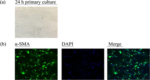 Figure 7. Characterization of rat primary GSMCs. (a) The isolated GSMCs were totally adherent and showed spindle-shaped, fibroblast-like morphology after 24 h of primary culture. (b) The cells underwent a specific α-SMA staining with Alexa Fluor 488-conjugated affinipure following with a nonspecific DAPI staining. An inverted fluorescence microscope was used to observe the cells. Scale bar = 100 μm (original magnification ×200). DAPI: 4′,6-diamidino-2-phenylindole; α-SMA: α-smooth muscle actin.