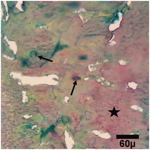 Figure 7. Microscopic section from the healing site of sham group on day 45 of healing. Bone deposition within cartilage (star) in healing site shows primary (arrows) ossification (trichrom ×100).