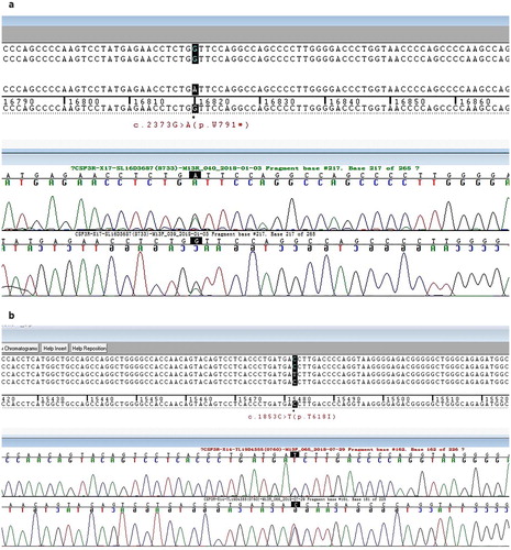 Figure 1. Detection of the W791* and T618I mutations in colony stimulating factor 3 receptor (CSF3R) during follow-up. (a) Sanger sequencing of exon 17 of CSF3R detected a base-pair mutation (G to A) at nucleotide 2373(p.W791*). (b) Sanger sequencing of exon 14 of CSF3R detected a base-pair mutation (C to T) at nucleotide 1853(p.T618I).