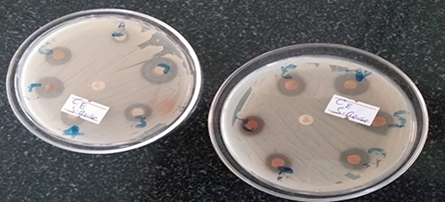 Figure 2 Methanol extract of Nigella sativa against P. mirabilis. Where Bm is methanol extract of black seed.