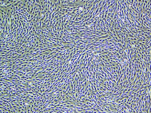 Figure 1. In a 400-fold magnified photo of human umbilical cord mesenchymal stem cells under an inverted microscope.