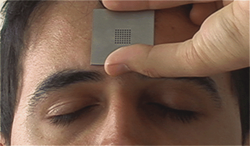 Figure 5. Marking on the face by the metal grid.