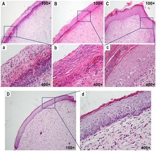 Figure 4 CA-CD-Cur–treated wounds showed optimized epithelialization.