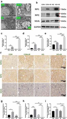 Figure 2. Effect of kidney-specific ALR knockout on necroptosis in kidney tissue in AKI mice. (a) The morphology of renal tissue cells observed by TEM, scale bar:2 µm. Western blotting (b) and quantitative data of the necroptosis-associated proteins RIP1 (c), RIP3 (d) and MLKL (e). The representative images of necroptosis-associated proteins (f) and relative integrated optical density of necroptosis-associated proteins(g-i). Data represent the mean ± standard deviation of at least three independent experiments, *P < 0.05, **P < 0.01, ***P < 0.001.