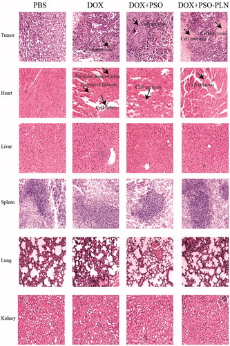 Figure 6. Pathological sections of tissues from mice bearing MCF-7/ADR xenografts after treatment. The organs sections were stained with hematoxylin and eosin. Scale bar is 5 μm.