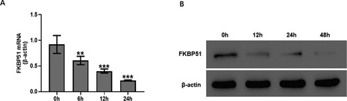 Figure 3. TGF-β1 inhibited FKBP51 expression in hASMC. Cells were treated with 10 ng/mL TGF-β1. (A) The FKBP51 mRNA level was detected by RT-qPCR assay. (B) The FKBP51 protein level was detected by western blotting. Data are expressed as mean ± SD (n = 3). **p < 0.01, ***p < 0.001 vs. 0 h.