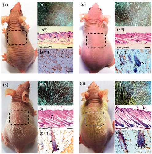 Figure 2. Gross phenotype (a–d) and the highlighted area are enlarged in (a′–d′) to show observation of dorsal skin. Skin specimen of dorsal skin of mice (a″–d″) haematoxylin and eosin (H&E) stained histology. Arrows indicate distorted hair follicles (b″, c″) and the straight hair shaft emerging through the epidermis (d″), Scale bar 500 µm. BrdU-labeled S-phase cells in the anagen hair bulb and outer root sheath (b″′, c″′ and d″′, brown color), scale bar 50 µm.