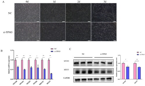 Figure 4. The effect of interfering with TPM3 on the differentiation of bovine myoblasts. (A) Phenotypic changes in induced differentiation of myoblasts after transfection with si-TPM3. (B) and (C) The expression of differentiation marker genes was detected by qRT-PCR and Western blots. Abbreviations: *P < 0.05 and **P < 0.01 respectively indicate significant and highly significant differences between the two groups.