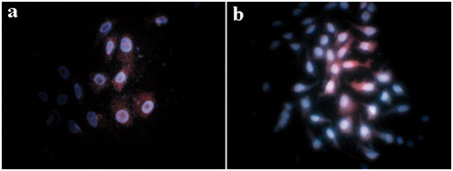 Figure 4. Fluorescent staining of nuclei in both osthole-treated and untreated cells by Hoechst 33258 and PI. HepG2 cells were incubated with 0.1 μmol/ml of osthole for 24 h. Cells untreated (a) and cells treated with osthole (b) stained with the fluorescent dye Hoechst 33528 and PI were visualized by fluorescence microscope. Condensed and fragmented nuclei and apoptotic bodies were seen in the osthole-treated cells (b), but not in the control (a).