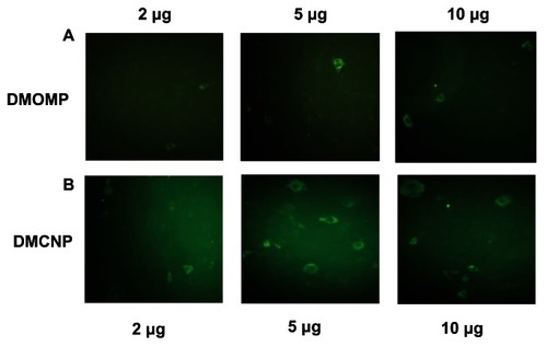 Figure 7 In vitro expression of MOMP protein in transfected Cos-7 cells. Cos-7 cells (1 × 106 cells/well) were transfected by electroporation with DMOMP (A) and DMCNP (B) at concentrations of 2, 5 and 10 μg.Notes: Transfected cells were incubated for 48 hrs at 37°C, fixed and blocked prior to incubation with goat anti-C. trachomatis polyclonal antibodies followed by a secondary FITC rabbit anti-Goat IgG (H+L) antibody. Immunofluorescence of cells were visualized using a Nikon Eclipse Ti-U microscope.Abbreviations: DMOMP, DNA of the major outer membrane protein of C. trachomatis; DMCNP, DMOMP encapsulated in chitosan nanoparticles; MOMP, major outer membrane protein of C. trachomatis.