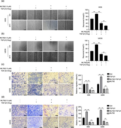 Figure 5. ML-792 inhibits TGF-β1-induced invasion and migration of human osteosarcoma cells (HOCs). HOCs were treated with or without TGF-β1(10 ng/mL) in the absence or presence of ML792(1 µmol/L) for 24 h. (A and B) Scratch wound healing was used to evaluate cell migration. Magnification, 100x. (C and D) Transwell assays were used to analyze cell invasion ability. Magnification, 100x. *P < 0.05, **P < 0.01. TGF-β1, transforming growth factor-β1.