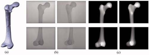 Figure 5. (a) Deformed 3 D model in which the deformation of the anteversion angle is 30˚. This deformed target was generated from the original No.10 femur. (b) C-arm images for the proximal and distal parts. The first column corresponds to C-arm images with a 0˚ view angle, whereas the second column corresponds to C-arm images with a 30˚ view angle. (c) Corresponding DRR images were obtained from the deformation model.