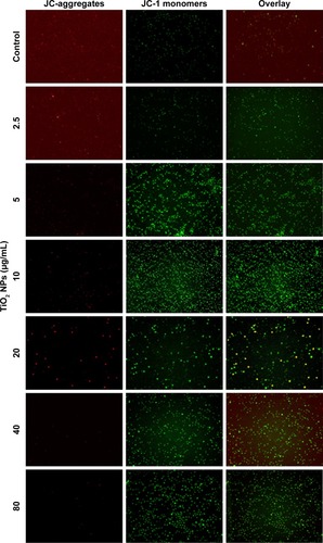 Figure 5 TiO2 NPs induced the disruption of MMP (Δψm) of RAW 264.7 cells.Notes: Cells were incubated with indicated concentrations of TiO2 NPs for 24 hours and incubated with 5 µM of JC-1 for 15 minutes, loaded on NC-Slide A8 and analyzed using fluorescence microscopy NucleoCounter® NC-3000™. Cellular JC-1 monomers and aggregates are detected as green and red fluorescence, respectively. Untreated cells were considered as control in the experiment. Magnification 200×.Abbreviations: TiO2, titanium dioxide; MMP, mitochondrial membrane potential; NPs, nanoparticles.