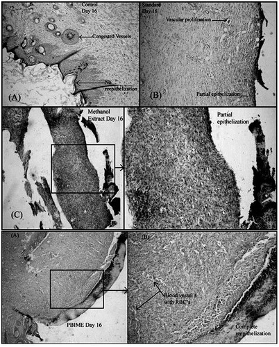 Figure 5. Histological changes in excision wounds of rats on the 16th day after treatment with various extracts of S. robusta resin. Congested blood vessels with no re-epithelization are seen in the control (A); partial epithelization is observed in framycetin (B), and methanol extract (C and D)-treated groups; complete epithelization with the formation of blood vessels (E and F) is seen in animals treated with PEBIME.