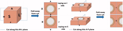 Figure 10. Illustration of how tissue is sectioned for macroscopic analysis.