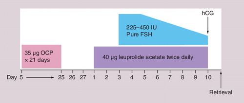 Figure 3. Oral contraceptive pill/microdose leuprolide protocol.FSH: Follicle-stimulating hormone; hCG: Human chorionic gonadotropin;IU: International units; OCP: Oral contraceptive pill.