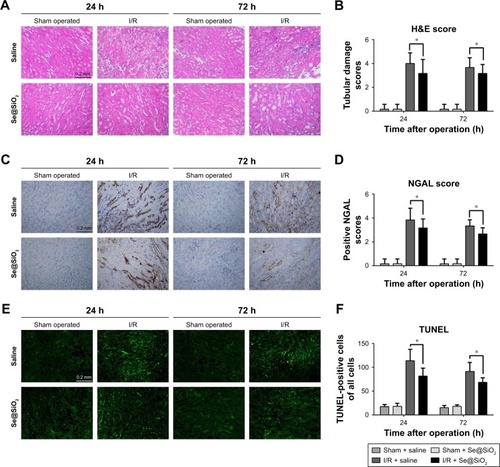 Figure 4 Histological analysis and apoptosis assessment for kidney tissues.Notes: (A) Mouse kidney tissues stained with H&E. Scale bars =0.2 mm. (B) Tubular damage in outer medullary tissues from sham groups and I/R groups was semi-quantified using pathological scores. *P<0.05. Data were expressed as means ± SDs (n=10). (C) NGAL was detected in kidney tissues by immunohistochemistry. Scale bars =0.2 mm. (D) Positive NGAL area in outer medullary tissues from sham groups and I/R groups was semi-quantified using scores. *P<0.05. Data were expressed as means ± SDs (n=10). (E) Apoptosis cells in tissue were detected using a TUNEL kit. Scale bars =0.2 mm. (F) Statistical analysis of TUNEL staining. The numbers of TUNEL- positive cells of all cells in the field was calculated under a fluorescent microscope. *P<0.05. Data were expressed as means ± SDs (n=10).Abbreviations: NGAL, neutrophil gelatinase-associated lipocalin; I/R, ischemia/reperfusion.