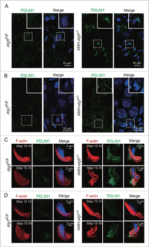 Figure 10. PDLIM1 is accumulated in the apical ES region of the autophagy-deficient mice. (A and B) Immunofluorescence analysis of PDLIM1 (green) was performed in Atg5Flox/Flox(left panels) and AMH-atg5−/− (right panels) testes (A), Atg7Flox/Flox(left panels) and AMH-atg7−/− (right panels) testes (B). Nuclei were stained with DAPI (blue). (C and D) Immunofluorescence analysis using phalloidin (red, labeled by TRITC) and PDLIM1 (green) was performed in the spermatids attached with some Sertoli cell regions of Atg5Flox/Flox(left panels) and AMH-atg5−/− (right panels) mice (C), Atg7Flox/Flox(left panels) and AMH-atg7−/− (right panels) mice (D). Nuclei were stained with DAPI (blue).