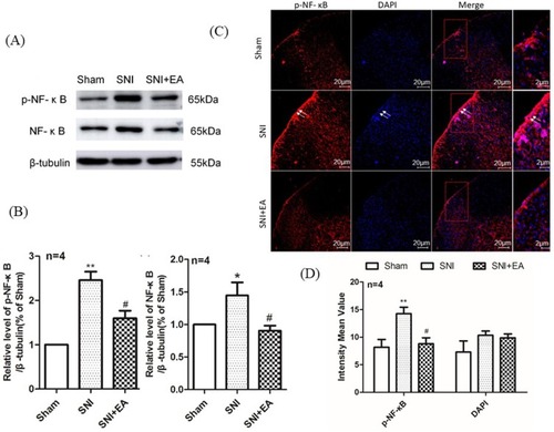 Figure 7 Effect of 2Hz EA on SNI-induced NF-κB activation in the spinal cord of rats.