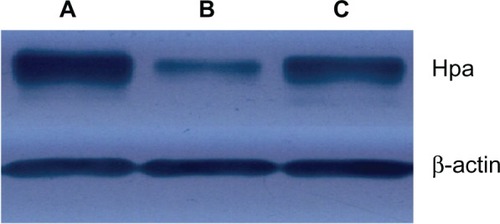 Figure 3 (A–C) Effect of Fe3O4-dextran-anti-β-human chorionic gonadotropin (HCG) carrying heparanase (Hpa) antisense oligodeoxynucleotide (ASODN) compounds on Hpa protein expression in JEG-3 cells. (A) Hpa protein expression in JEG-3 cells. (B) Hpa protein expression in Fe3O4-dextran-anti-βHCG-Hpa ASODN-treated cells. (C) Hpa protein expression in Fe3O4-dextran-anti-βHCG-Hpa nonsense oligonucleotides-treated cells.