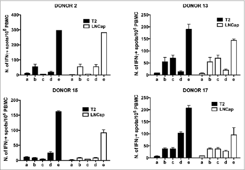 Figure 6. Elispot analysis of the reactivity of GX301 peptide-specific T cell lines from donors N. 2, 13, 15 and 17 against T2 and LNCap, telomerase-expressing tumor cell lines. Panels A, B, C and D refer to analyses performed with the T cell line against peptides C from donor N. 2, the T cell line against peptide B from donor N. 13, the T cell line against peptide A from donor N. 15, and the T cell line against peptide D from donor N. 17, respectively. Analyses were performed using T2 (black bars) or LNCap (open bars) tumor cell lines as target cells. a) tumor target cells alone; b) freshly purified autologous donor PBMC alone; c) peptide-specific T cell line alone; d) PBMC plus tumor target cells; e) peptide-specific T cell line plus autologous PBMC plus tumor target cells.