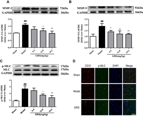 Figure 5 Effects of GRS on MMP-2/9 and p-MLC in I/R mice. Mice were subjected to 1 h of ischemia, followed by reperfusion for 24 h. GRS (6.4, 12.8, or 19.2 mg/kg) was administered immediately before reperfusion. MMP-2 (A), MMP-9 (B) and p-MLC (C) levels were quantitatively analyzed via Western blot. Data are presented as means ± SD, n =3. ##P < 0.01 vs sham group; *P < 0.05 vs model group; **P < 0.01 vs model group. (D) Confocal immunofluorescent images of p-MLC (green) and the endothelial marker CD31 (red) in the ischemic hemisphere. Scale bar = 100 µm.