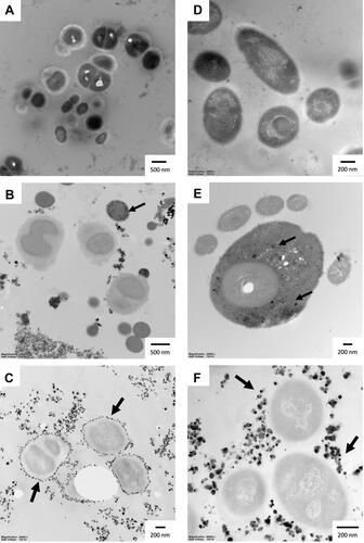 Figure 6 Ultrastructure of S. maltophilia and S. mutans after treatment with AgNPs for 24 hours: (A) S. maltophilia control; (B) S. maltophilia treated with AgNPs-CHL; (C) S. maltophilia treated with AgNPs-PEG-MET; (D) S. mutans control; (E) S. mutans treated with AgNPs-CHL; (F) S. mutans treated with AgNPs-PEG-MET. The scale bar is present on the left side of each picture. Arrows indicate NPs.