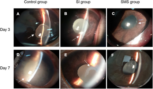 Figure 3 Images of the ocular appearance for the control group (A and D), SI group (B and E), and SMS group (C and F) on post-treatment days 3 and 7. The eyes in the control group had severe anterior chamber fibrin and vitreous opacity, whereas there were less inflammatory signs in the SI group and SMS group. The eyes at day 7 in the SMS group appeared normal. The arrow indicates the response of inflammation.