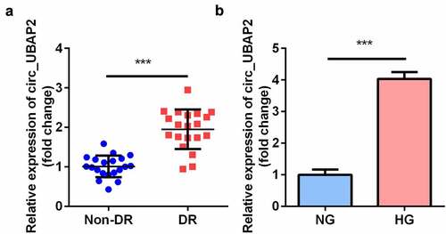 Figure 1. The expression levels of circ-UBAP1 in human vitreous humor and hRMECs. (a) Vitreous humor samples were collected from DR patients (n = 30) and non-DR people (n = 30) to analyze the expression of circ-UBAP1 using RT-qPCR. (b) circ-UBAP2 expression was measured after hRMECs were treated with HG or NG. Each experiment was performed in triplicate. ***P < 0.001. DR, diabetic retinopathy; hRMECs, human retinal microvascular endothelial cells; HG, high glucose; NG, normal glucose