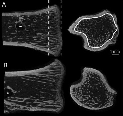 Figure 1. Region of interest used for µCT analysis. Frontal and transverse sections of the proximal tibia (epiphysis removed) from saline-treated (A) and Scl-Ab-treated (B) weight-bearing animals. A 1.5-mm long region in the metaphysis was chosen (dashed lines). In this region, only the trabecular bone was evaluated (white trace). This region was situated away from the screw (*) so that it would not be influenced by any bone formation around the screw.
