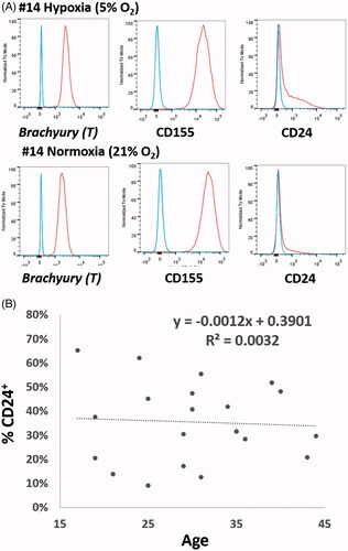 Figure 1. (A) NP cells show high positive expressions of brachyury T and CD155 either under hypoxic or normoxic expansion. No significant differences were noticed in brachyury T and CD155 expression between normoxic and hypoxic cultivations. On the contrary, the percentage positivity for CD24 in NP cells varied among patients. (B) There was also no correlation between the rates of CD 24 expression and the age of patients.