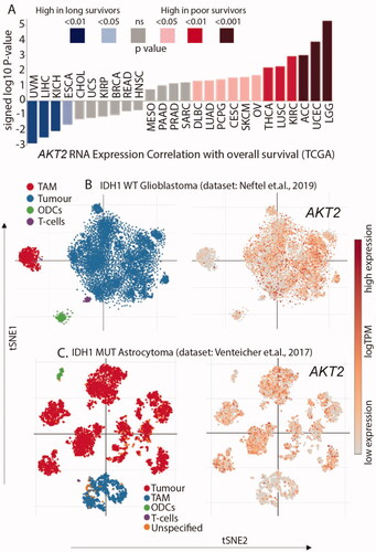 Figure 3. AKT2 is overexpressed in glioma (A) High expression of AKT2 mRNA correlates with poorer survival in LGG patients. Individual values are sign-corrected log10 p-values of correlation. Non-abbreviated names of the cancer types: UVM: Uveal Melanoma; LIHC: Liver hepatocellular carcinoma; KICH: Kidney Chromophobe; ESCA: Oesophageal carcinoma; CHOL: Cholangiocarcinoma; UCS: Uterine Carcinosarcoma; KIRP: Kidney renal papillary cell carcinoma; BRCA: Breast invasive carcinoma; READ: Rectum adenocarcinoma; HNSC: Head and Neck squamous cell carcinoma; MESO: Mesothelioma; PAAD: Pancreatic adenocarcinoma; PRAD: Prostate adenocarcinoma; SARC: Sarcoma; DLBC: Lymphoid Neoplasm Diffuse Large B-cell Lymphoma; LUAD: Lung adenocarcinoma; PCPG: Pheochromocytoma and Paraganglioma; CESC: Cervical squamous cell carcinoma and endocervical adenocarcinoma; SKCM: Skin Cutaneous Melanoma; OV: Ovarian serous cystadenocarcinoma; THCA: Thyroid carcinoma; LUSC: Lung squamous cell carcinoma; KIRC: Kidney renal clear cell carcinoma; ACC: Adrenocortical carcinoma; UCEC: Uterine Corpus Endometrial Carcinoma; LGG: Brain Lower Grade Glioma. (B) AKT2 expression is highest in the tumour cell population of IDH1 WT GBM single-cell RNAseq dataset. (C) AKT2 expression is highest in the tumour cell population of IDH1 mutant astrocytoma single-cell RNAseq dataset.