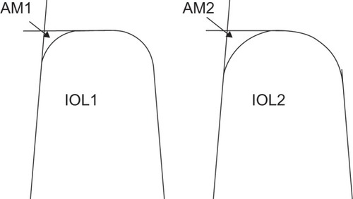 Figure 2 Graphical representation of the assessment of intraocular lens (IOL)-edge sharpness, based on measurement of the area deviating from a perfect square on electron photomicrographs (see text). in these stylized IOLs drawn in section, IOL1 has a smaller area measurement (AM1) than IOL2 (AM2), and therefore has a squarer edge.