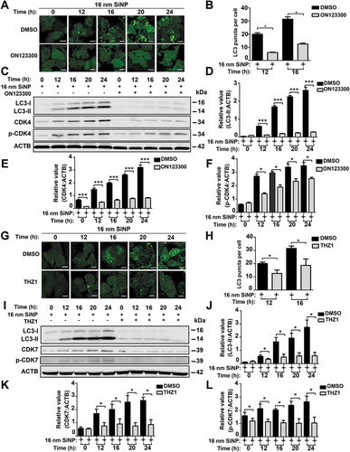 Figure 8. The inhibition of CDK4 or CDK7 by kinase inhibitors blocks autophagy activation induced by SiNPs. (A) GFP-LC3 NRK cells were incubated with the inhibitor ON123300 for 24 h, and then treated with 16-nm SiNP at 60 μg/mL for 0, 12, 16, 20 or 24 h. Scale bar: 10 μm. (B) The GFP-LC3 puncta were observed and measured by confocal microscopy, and the number of GFP-LC3 puncta was quantified in ≥ 30 cells. (C) The immunoblotting analysis of the LC3-II expression in NRK cells, which were treated with ON123300 or DMSO for 24 h and then stimulated by 16-nm SiNPs. The relative expression of (D) LC3-II, (E) CDK4 or (F) p-CDK4 was calculated by the ratio of LC3-II:ACTB, CDK4:ACTB or p-CDK4:ACTB, respectively. (G) GFP-LC3 NRK cells were incubated with the inhibitor THZ1 for 24 h and then treated with 16-nm SiNP at 60 μg/mL for 0, 12, 16, 20 or 24 h. Scale bar: 10 μm. (H) The GFP-LC3 puncta were observed and measured by confocal microscopy, and the number of GFP-LC3 puncta was quantified in ≥ 30 cells. (I) The immunoblotting analysis of LC3-II in NRK cells, which were treated with THZ1 or DMSO and then stimulated by 16-nm SiNPs. The relative expression of (J) LC3-II, (K) CDK7 or (L) p-CDK7 was calculated by the ratio of LC3-II:ACTB, CDK7:ACTB or p-CDK7:ACTB, respectively. * p < 0.05; *** p < 0.001