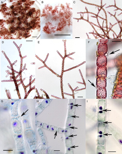 Figure 4. Field-collected samples of Bonnemaisonia hamifera. A-F, freshly collected; G-I, dead thalli. A–B, Clumps of B. hamifera showing irregular outlines. Scale bar = 1 cm. C–E, Filaments of B. hamifera with irregular to alternate branching. Scale bar = 100 µm. F–G, Portion of filaments with gland cells (arrows). Scale bar = 20 µm. H–I, Portions of filaments stained showing aniline blue with prominent, single rhodophysin granules in each cell, and pit connections between adjoining cells (arrows). Scale bar = 20 µm.