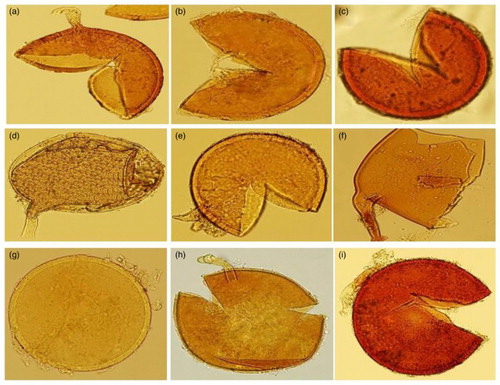 Figure 1. (a–i) Morphology of typical an intact crushed spores of AMF. (a, b, c) C. etunicatum (syn. G. etunicatum); (d, e, f) F. mosseae (syn. G. mosseae); (g, h, i), R. intraradices (syn. G. intraradices).