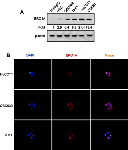 Figure 2 ERO1A protein expression in CCA cell lines. (A) Western blot analysis of ERO1A expression. (B) Localization of ERO1A was detected by immunofluorescence assay, and cytoplasmic staining was observed (400×).