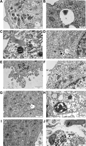 Figure 5 Glioblastoma multiforme cells (A–F) and tumors (G–J) ultrastructure from control group (A, G) after GO treatment (B, C, H) and rGO treatment (D, E, F, I, J). Notes: Scale bar: A, E, F, G, and H, 1 μm; B and C, 200 nm; D and I, 500 nm; J, 2 μm.Abbreviations: N, nucleus; M, mitochondria; ER, rough endoplasmic reticulum; V, vacuole; AG, Golgi apparatus; GO, graphene oxide; rGO, reduced graphene oxide.