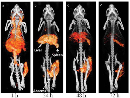 Figure 4. MicroSPECT/CT images of a mouse with a S. Aureus abscess in the left thigh muscle. Images were acquired at 1 h, 4 h, 24 h, 48 h and 72 h after injection of 111In-labeled PEGylated liposomes. At all time points uptake in the abscess and the characteristic splenic and hepatic uptake is visualized (arrows) (Reproduced with permission from van der Geest et al. [Citation49]).