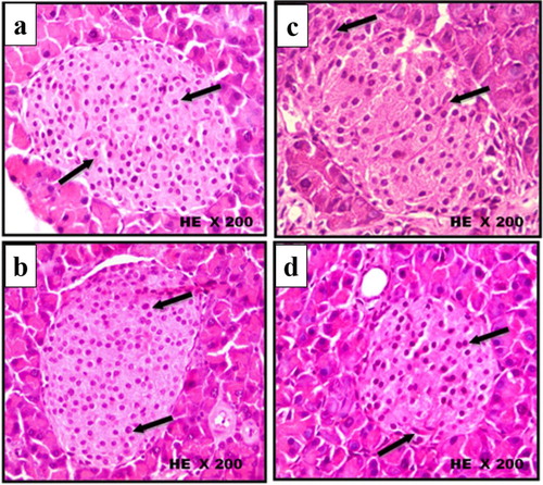 Figure 5. Histological changes in islets of Langerhans of mice pancreas after treatment intraperitoneally with scorpion extract for five five weeks showing β-cells shape in experimental groups. (a) Negative control group, (b) scorpion extract (300 mg/kg), (c) diabetic group by alloxan and (d) diabetic received scorpion extract. Hematoxyline and Eosin (H&E) stain at magnification power ×200.