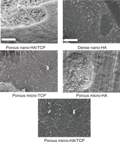 Figure 9 Representative SEM images of osteoclast resorption pits on the various substrates after 21 days of culture.Note: Magnifications =10,000×.Abbreviations: SEM, scanning electron microscopy; HA, hydroxyapatite; TCP, tri-calcium phosphates.