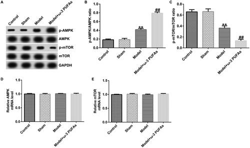 Figure 4. AMPK/mTOR pathway in kidney tissues from CLP-treated rats. (A) Protein expression of AMPK, p-AMPK, mTOR, and p-mTOR. (B) Quantified results of p-AMPK. (C) Quantified results of p-mTOR. (D and E) mRNA levels of AMPK and mTOR evaluated using qRT-PCR. **p < 0.01 vs. Sham; ##p < 0.01 vs. Model.