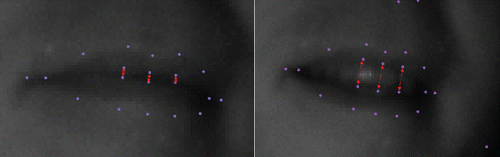 Figure 10. Detailed images of the mouth region, including landmarks of upper and lower lips.