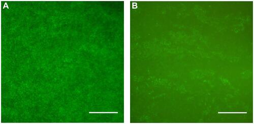 Figure 7 Live/dead assay of Pseudomonas aeruginosa attached on (A) PEEK and (B) PEKK samples (SYTO® 9 and propidium iodide respectively stained live [green] and dead [red] bacteria cells).